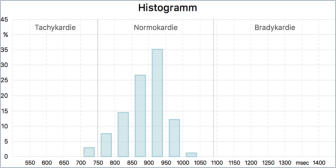 Histogramm VNS-Analyse