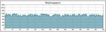 Rhythmogramm VNS Analyse