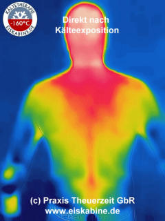 Thermografie-Diagnostik