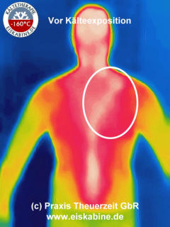 Thermografie