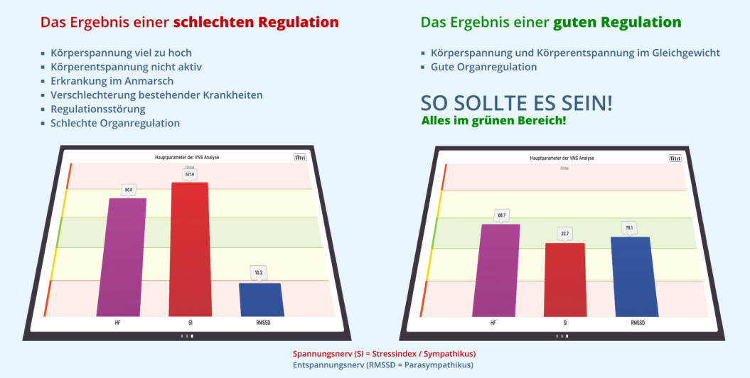 VNS Analyse Bonn